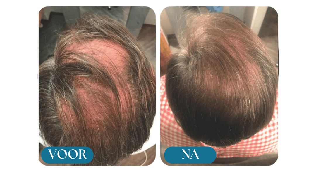 Morge Skin™ Haarwortel Activator Shampoo