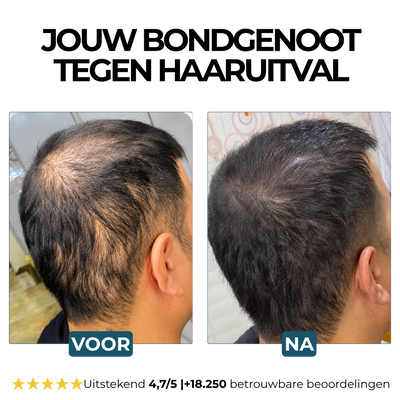 Morge Skin™ Haarwortel Activator Shampoo