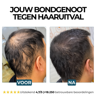 Morge Skin™ Haarwortel Activator Shampoo