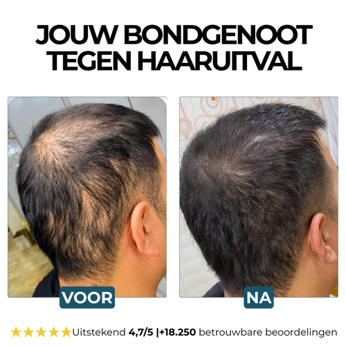Morge Skin™ Haarwortel Activator Shampoo