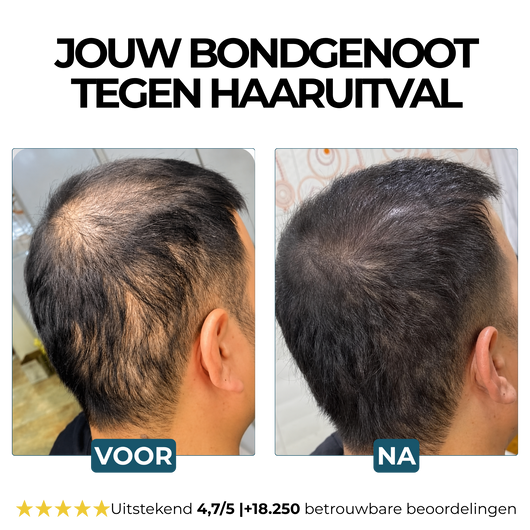 Morge Skin™ Haarwortel Activator Shampoo