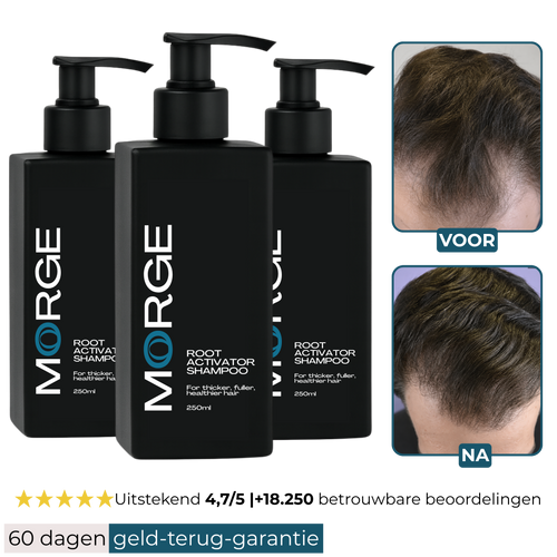 Morge Skin™ Haarwortel Activator Shampoo