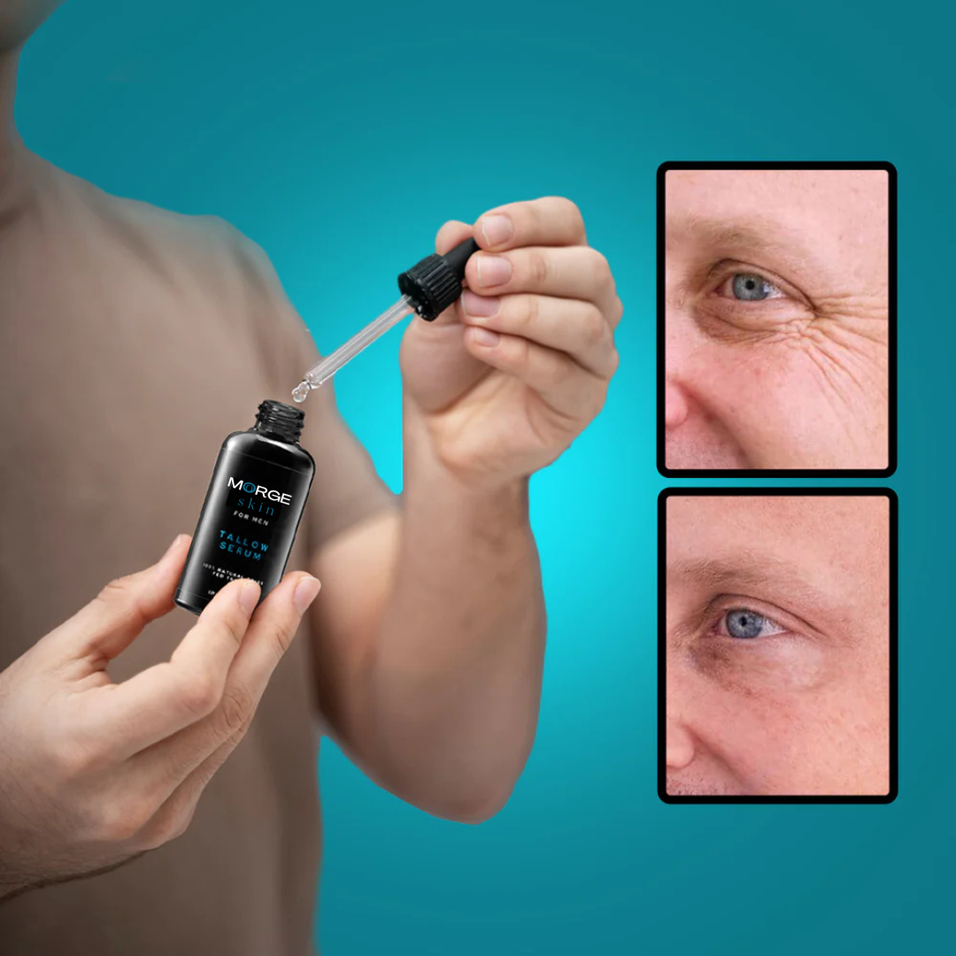 Morge™ Anti-Rimpel Nachtserum (GRATIS)