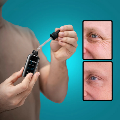 Morge™ Anti-Rimpel Nachtserum (GRATIS)